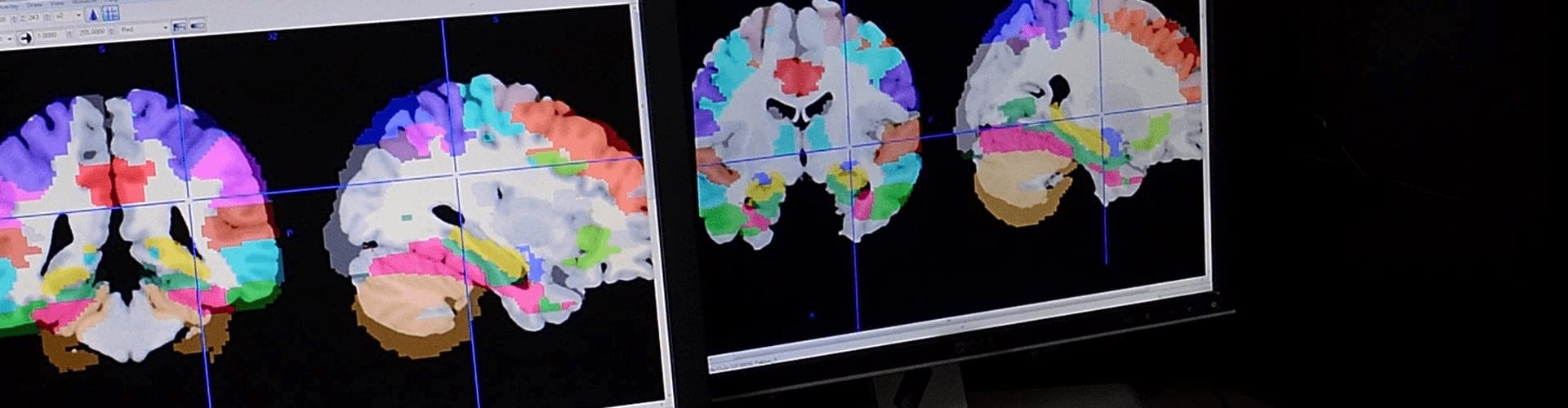 Digital scans of a brain