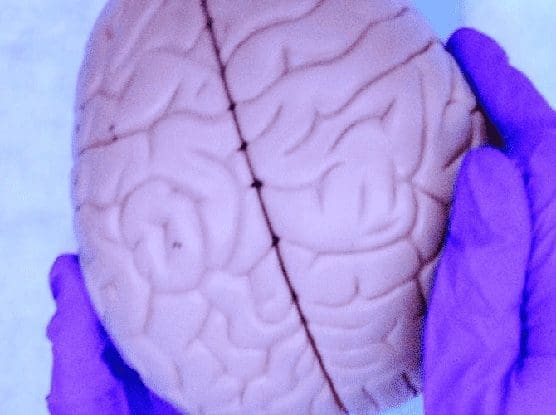 purple-gloved hands holding a model of a brain