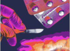 orange and purple colored illustration of a surgical knife and gloved hand